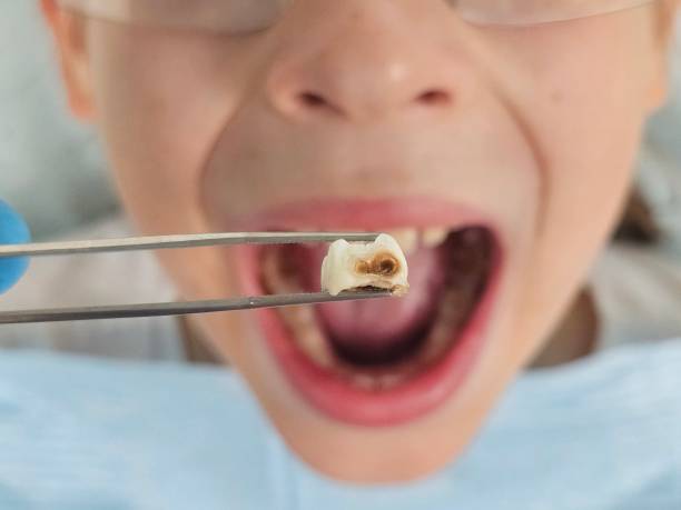 Best Emergency Dental Care for Sports Injuries in Friars Point, MS